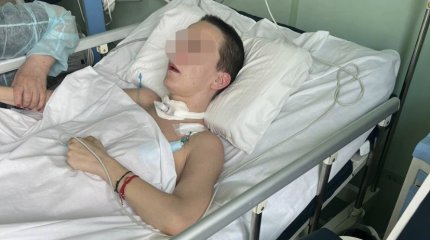 Женщина впала в кому после блефаропластики