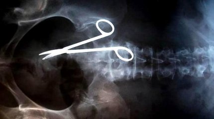 Житель Туркестанской области обвиняет врачей в нетрадиционной медицине