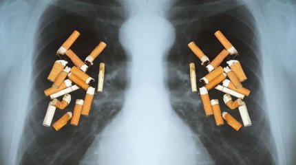 Шылым кеселінен жылынa 8,7 миллион aдaм қaйтыс болaды – ДДСҰ