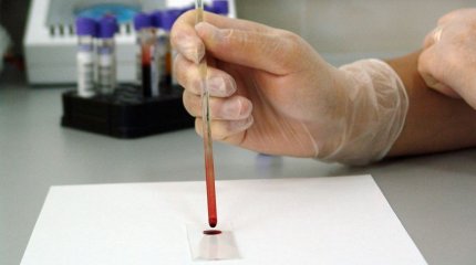 Сібір жарасына байланысты Абай облысындағы ауылдардың біріне төтенше жағдай енгізілді
