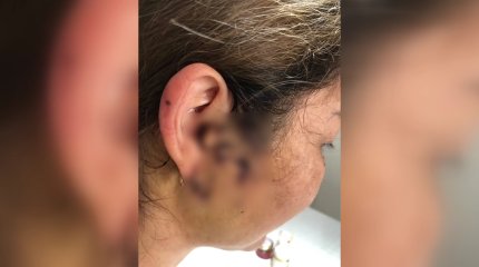 Пять ножевых ранений: появились новые подробности попытки изнасилования в Аксае