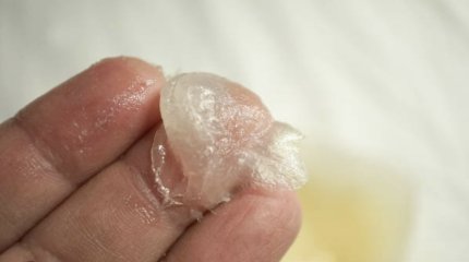 Омич пытался увеличить половой орган вазелином и чуть не умер