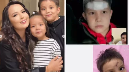 "Қан тоқтамай ағып, кілемнің үстіне тамшылап жатыр". Әнші Жұлдыз Өмірғали басына түскен қиын сынақ туралы айтты