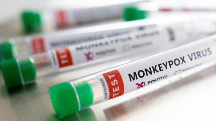 Во Вьетнаме зафиксировали первый случай передачи оспы обезьян от человека к человеку