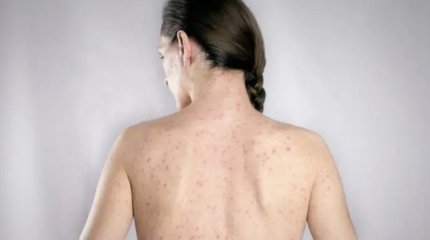 Мужчина умышленно заражал женщин ВИЧ в Карагандинской области