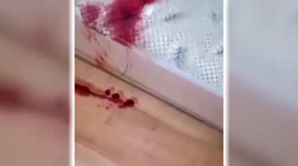 Қызылжарда жанжал кезінде пышақтан зардап шеккен студент ауруханаға түсті