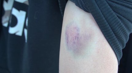 Медработники заявили о нападении заключённого в колонии Уральска