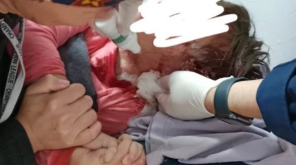 Собаки напали на пятилетнего ребенка на детской площадке в ЗКО