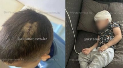Ребёнка ударили стулом по голове: полиция Астаны начала проверку
