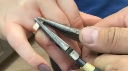 Спасатели освободили палец карагандинки от кольца