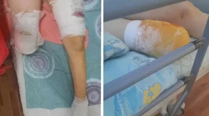 Оралда тепловоз қағып кеткен 15 жасар қыз бір аяғынан айырылды