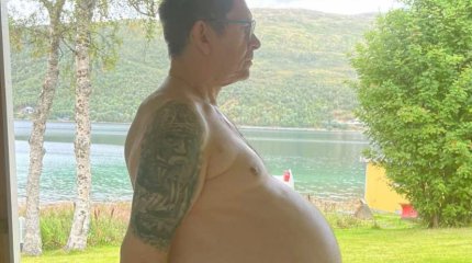 Врачи 12 лет не замечали у мужчины опухоль в животе