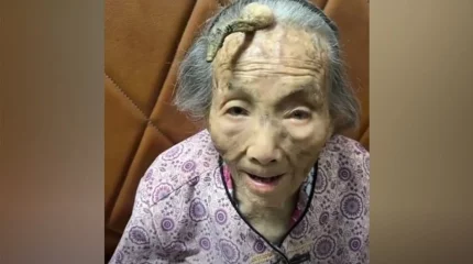 107 жастағы кейуана 10 сантиметрлік мүйізінің арқасында әлемге танылды