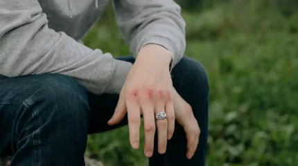 Қызылордада 14 жасөспірім бейімдеу орталығына жеткізілді