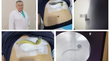 10 жастағы оқушы мектепте жантүршігерлік жарақат алған