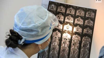 Павлодарда мектеп оқушысының басына шкафтың сынған есігі құлаған