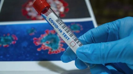 Алматыда коронавирус жұқтырғандар саны артып келеді