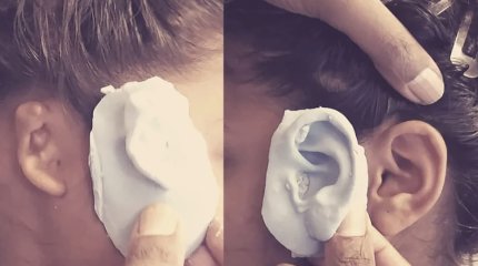 Принести на операцию свои инструменты предложили пациенту из Атырау