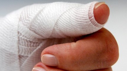 Костанайца оштрафовали на 400 тысяч тенге за повреждённый ноготь сотрудницы