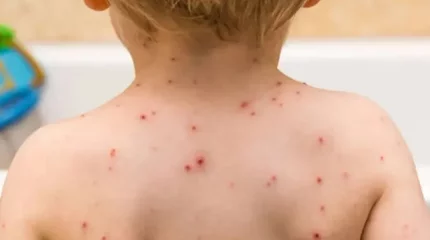 Қызылшадан 7 адам қайтыс болды