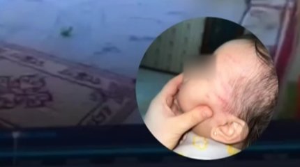 С ссадинами на голове вернулся ребёнок из детского сада в Туркестане