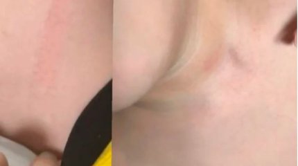 В Алматы родитель чуть не задушил одноклассника своего сына в отместку за драку мальчишек