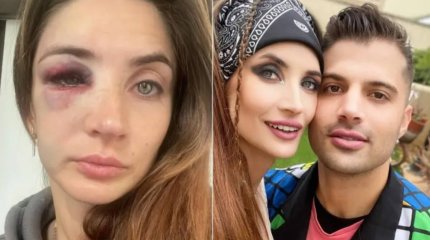 «Өміріме қауіп төніп тұр»: Қазақстанның бұрынғы волейболшысы соққыға жығылғанын айтты