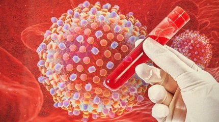 В Казахстане растет заболеваемость гепатитом А