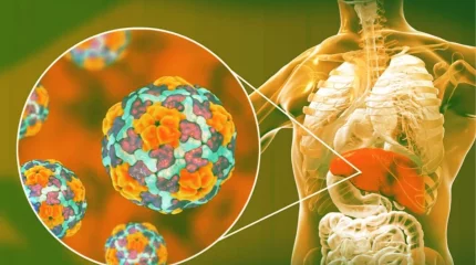 Қазақстанда А гепатитімен сырқаттанғандардың саны 850-ге жетті