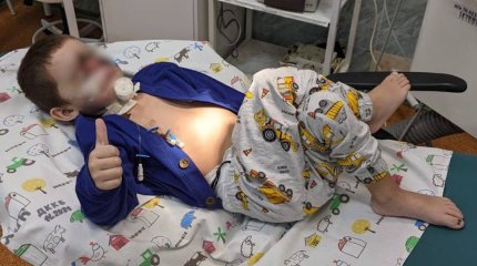 Хирурги пришили ребёнку лицо, откушенное собакой