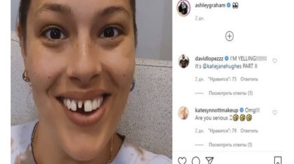 Тіс өсіретін дәрі адамдарға сынала бастады