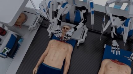 Немецкие ученые готовятся пересаживать людям головы (ВИДЕО)