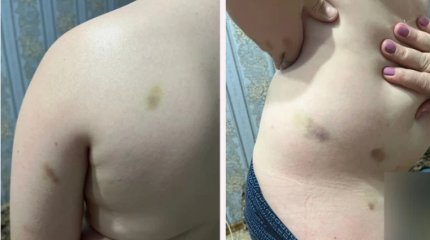 10-летнего ребёнка избили в детском лагере Уральска