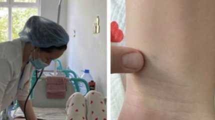 Атырауда қарақұрт қаптады: екі бала жансақтау бөліміне түскен