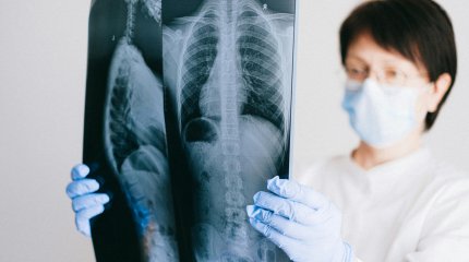 Пройти бесплатный скрининг легких приглашают казахстанцев