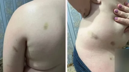 Оралда лагерьде 10 жастағы баланы соққыға жыққан: Директор жұмыстан қуылды