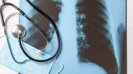 Қостанай облысында 200-ден аса адам қауіпті дертке шалдыққан