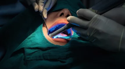 Болашақта тіс дәрігерін робот алмастыруы мүмкін