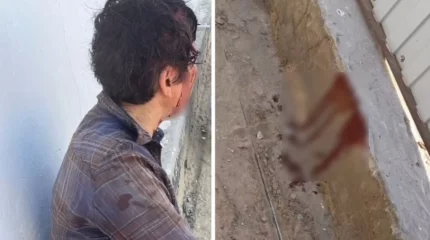 "Қарызымды өтеу үшін ақша бермесең бауыздаймын": Атырауда ер адам көрші әйелдің басын жарып, 600 мың теңгесін алып кеткен