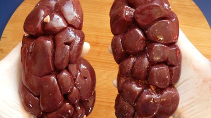 Актюбинец хотел продать свои органы за 9 млн тенге