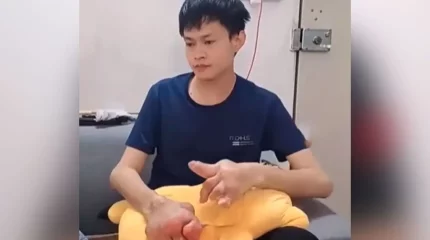 Аяқ-қолы ісіп кеткен: қазақ жігіт энергетикті көп ішкен адамның жағдайын көрсетті