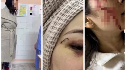 Кеудесін тістеп, шап тұсынан ұрған: Алматыда науқас дәрігерлерге шабуыл жасаған