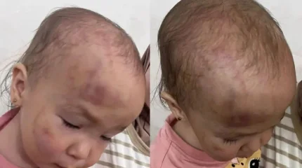 Мама избитой в актауском детском саду девочки винит следствие в бездействии