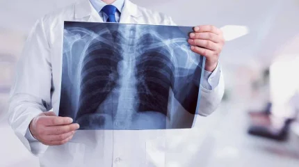 Атырау облысында туберкулез ауруының деңгейі 15,5%-ға төмендеді