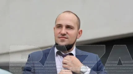 Мужчина умер при пересадке волос в России