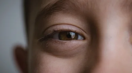 Казахстанцев лишили возможности лечить глаза пенсионными «излишками»