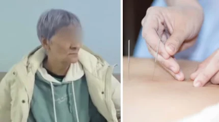 Жительнице Усть-Каменогорска проткнули лёгкое во время иглоукалывания