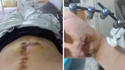 Оралда баланың жағын сындырғандар оны арашалаған жігіттен кек алу үшін үйінің жанында атып кеткен