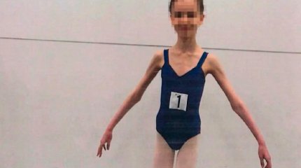 Родители довели дочь-балерину до истощения