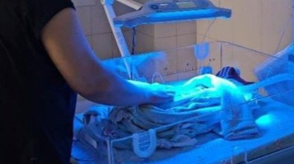 Шымкенттік дәрігерлер жүрегі тоқтап қалған шақалақты аман алып қалды